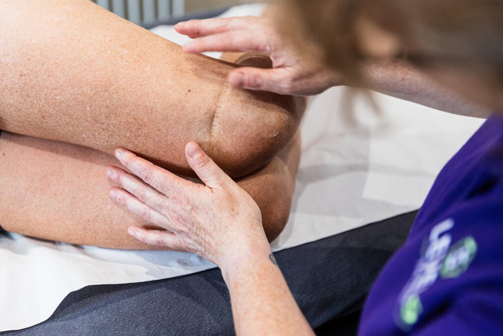 Scar Therapy treatment